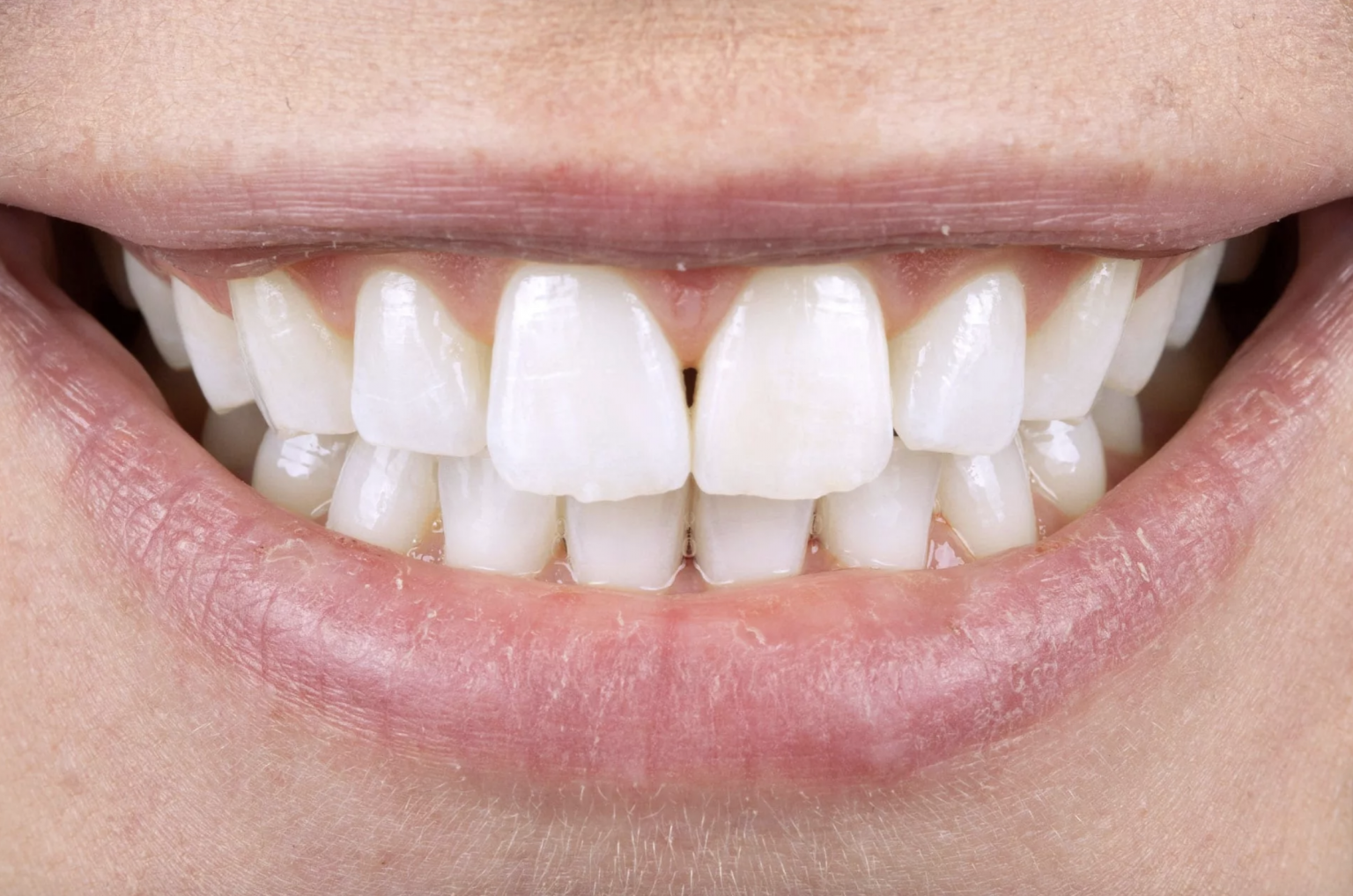 Dentist Coventry Face Dental Practice Private & NHS