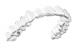 Invisalign Coventry clear braces