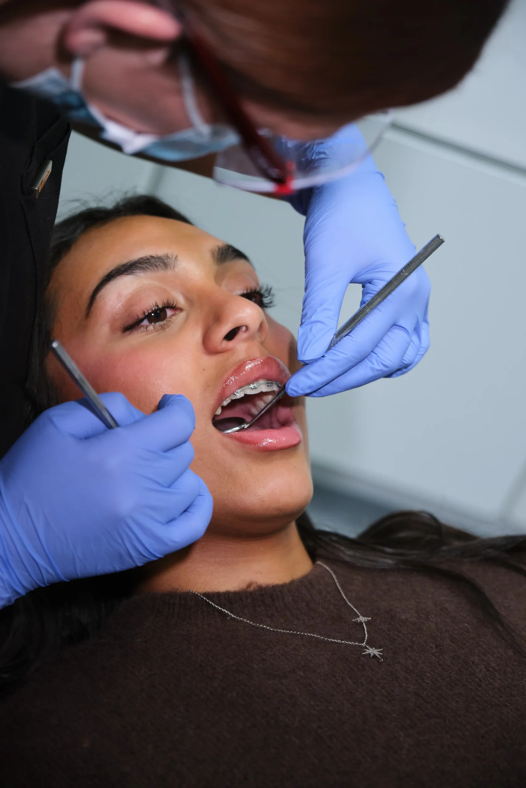 Teeth Straightening