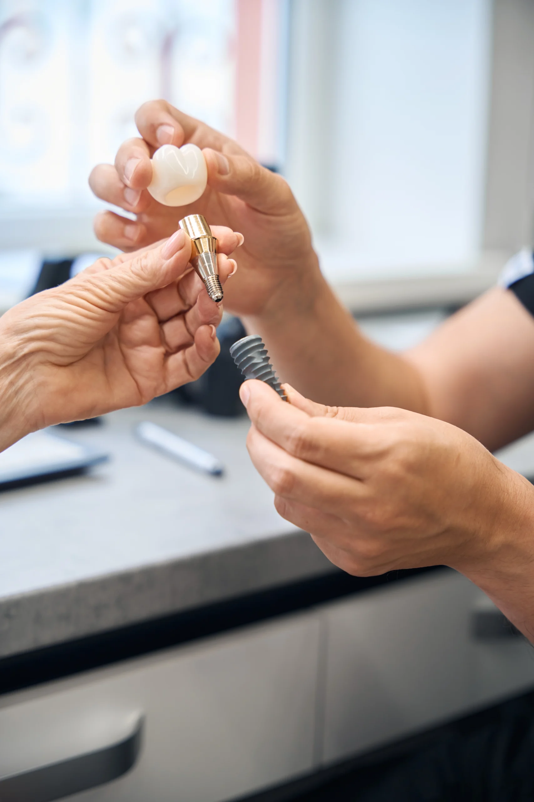 Dental implants