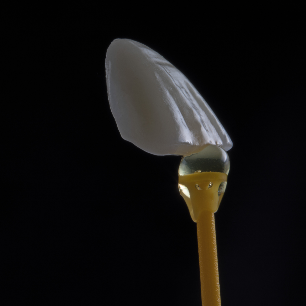 Porcelain veneers