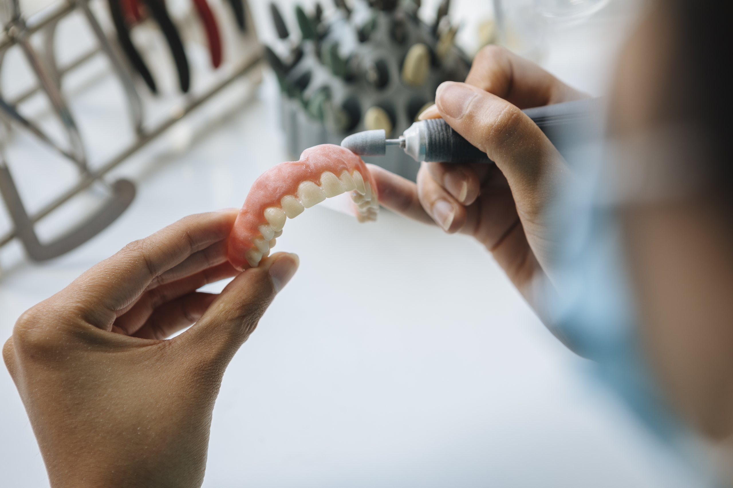 Dentures at Face Dental, Coventry