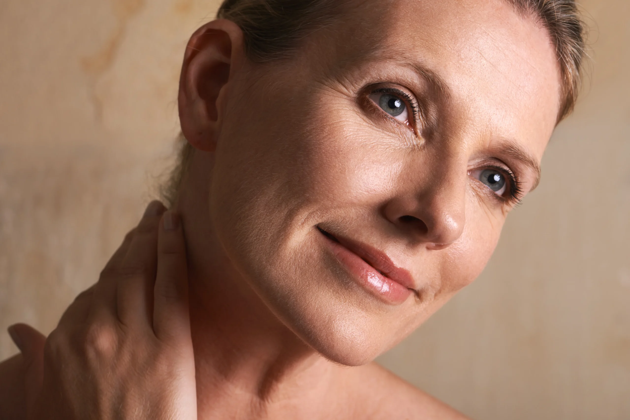 Profhilo treatment at Face Dental Coventry