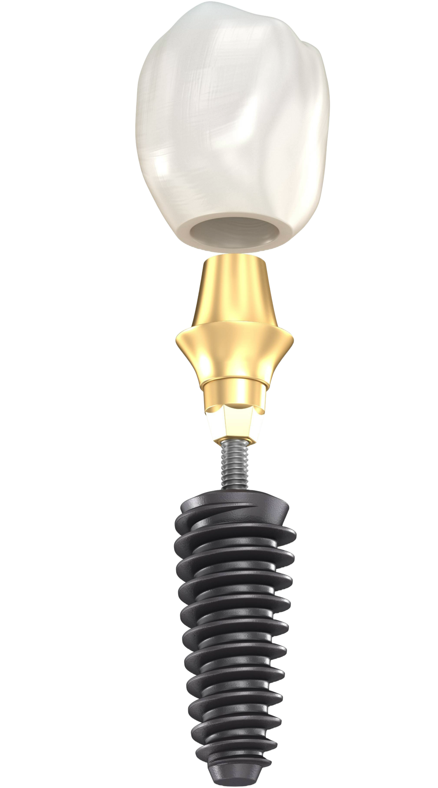 Diagram of a dental implant showing the crown, abutment, and fixture