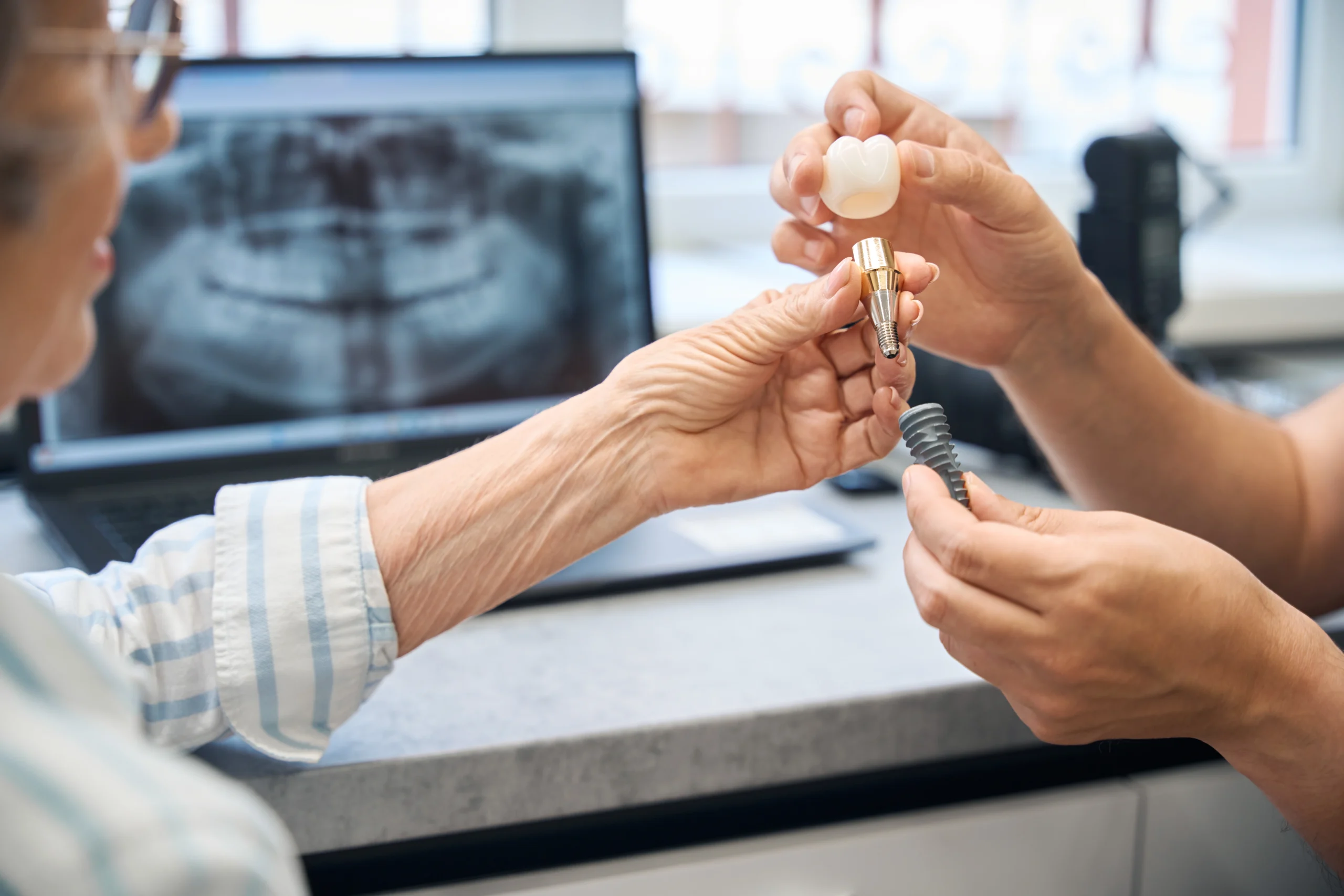 Dental implant treatment at Face Dental, Coventry