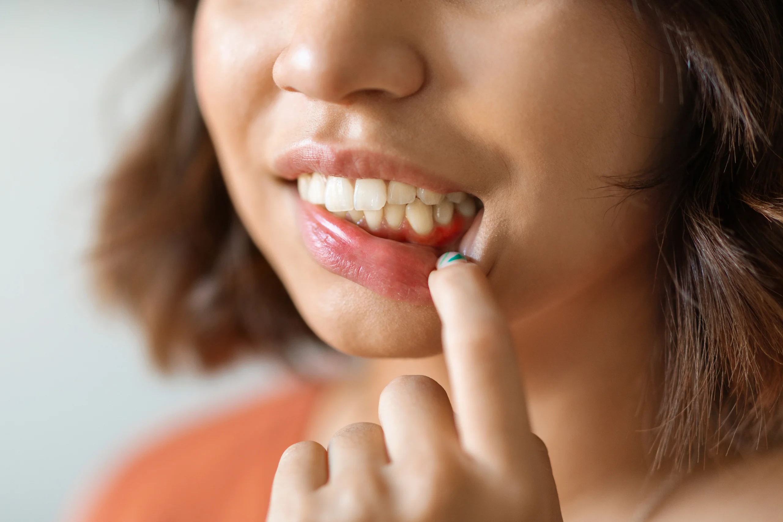 Gum disease treatment at Face Dental, Coventry