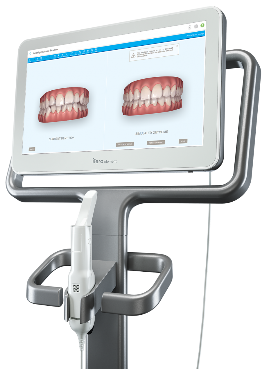 iTero Element scanner