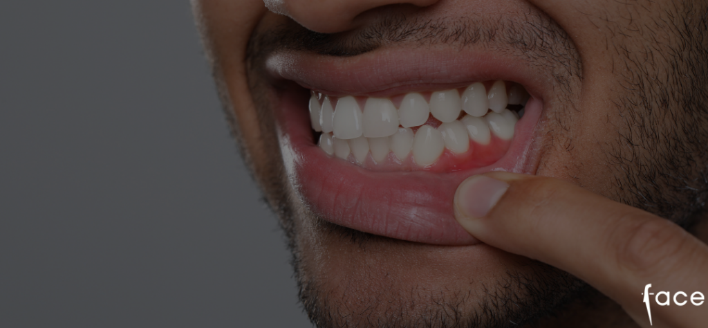 inflamed gums - what it means