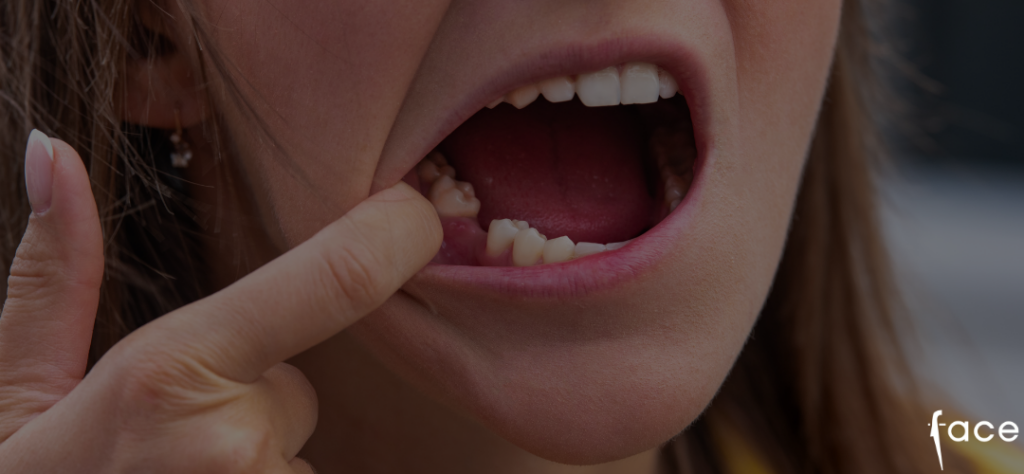 first night after tooth extraction - what do expect - dentist advice
